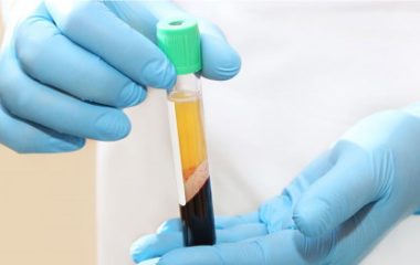 плазмотерапия-450x263